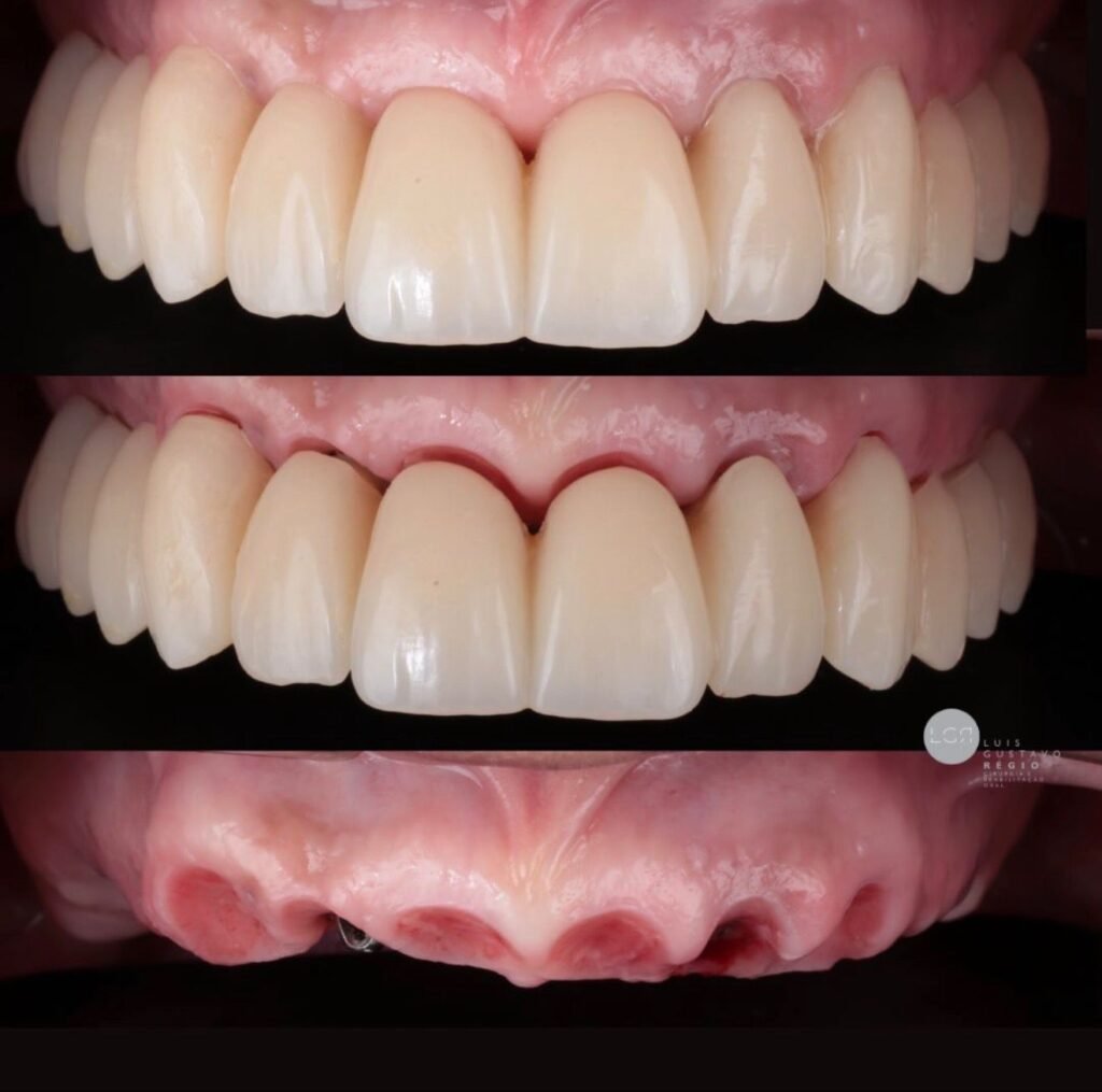 01 - ANTES E DEPOIS - 31.07