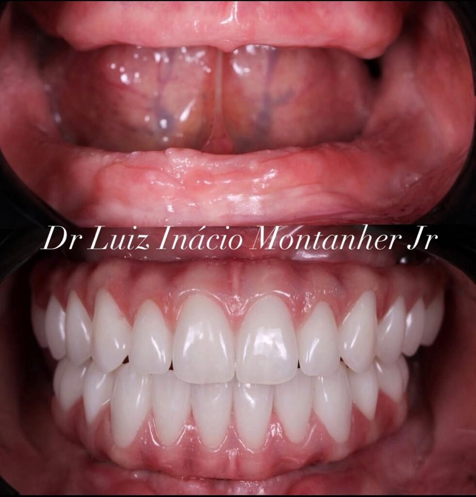 02 - ANTES E DEPOIS - 31.07